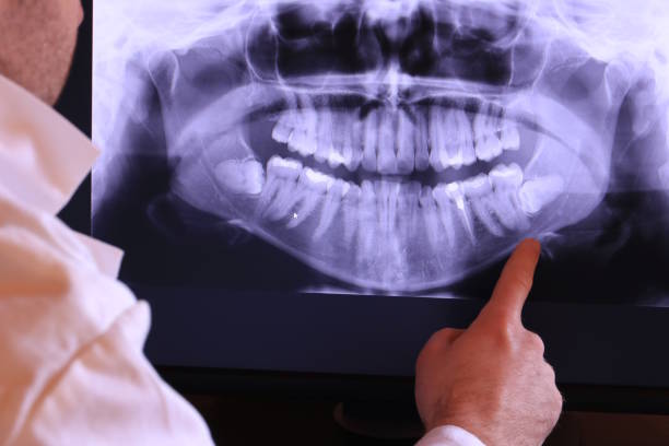 Best Root Canal Emergency Dentist  in Arlington Heights, WA