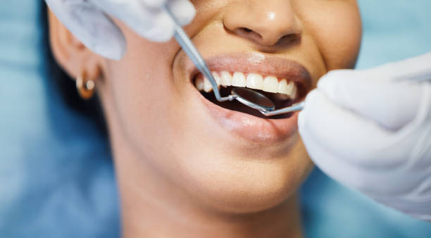 Best Chipped Tooth Repair Near Me  in Arlington Heights, WA